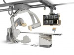 Angiografo Angiografo